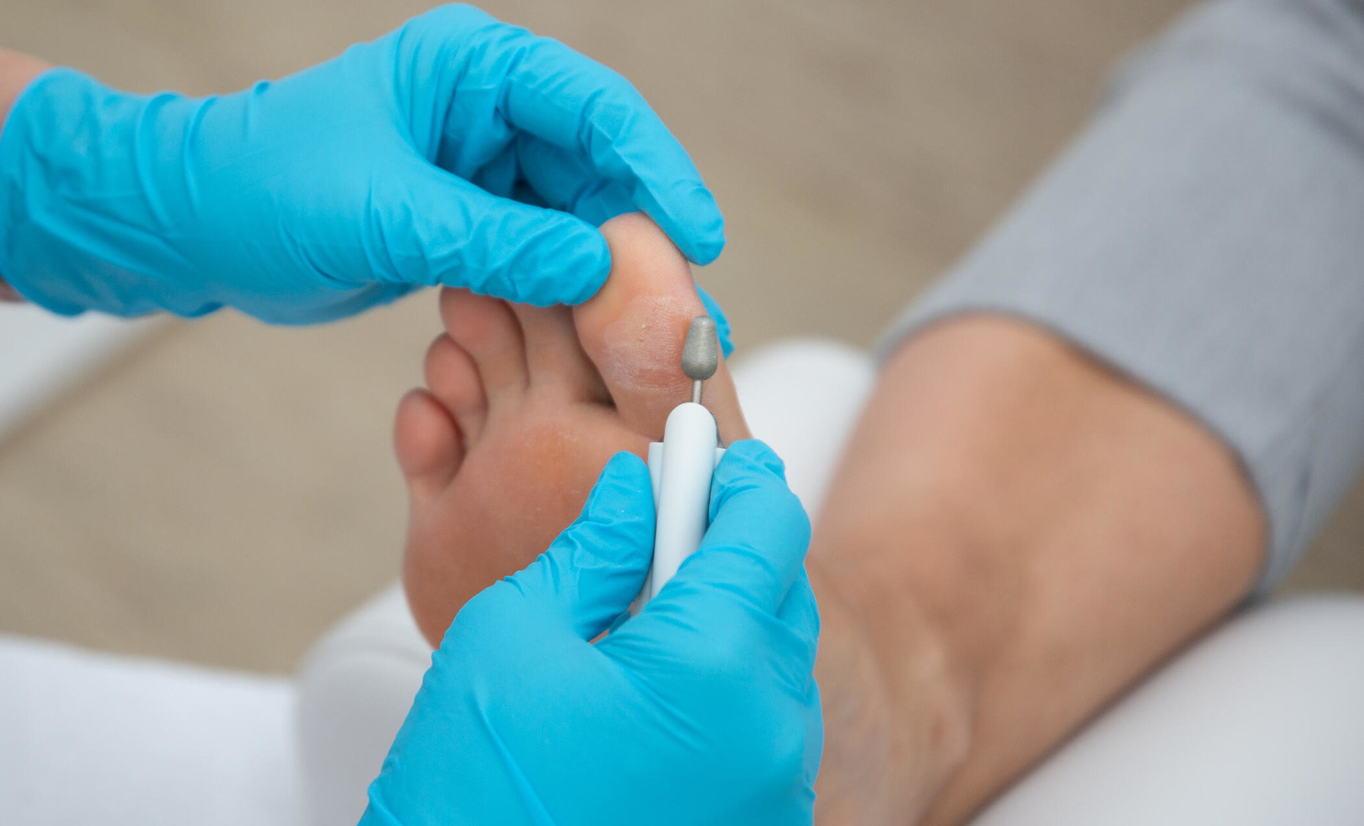 medizinische Fußpflege bei Holy feet